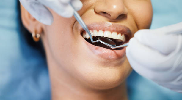 Best Emergency Dental Care for Broken or Chipped Teeth in Brusly, LA